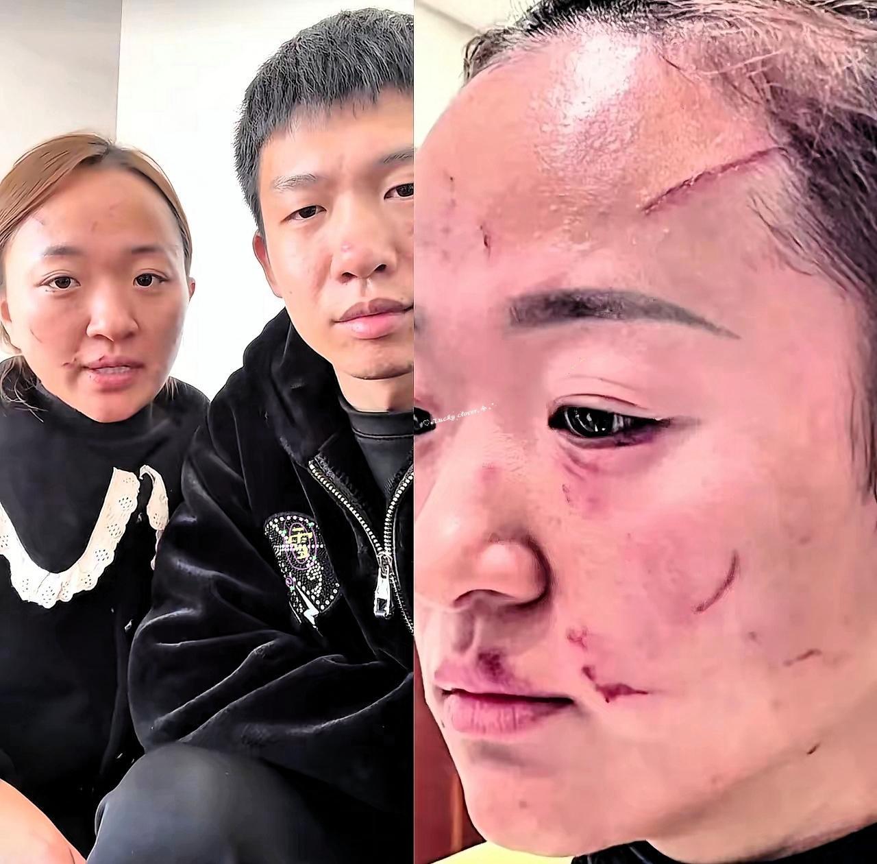 婆婆与媳妇打架后续来了，最终经帽子叔叔调解，婆婆给媳妇5w，以后互不来往。当儿子