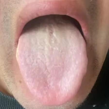 今日舌象分析：睡眠差 大便次数多
 
1、“舌色整体偏淡”——气血虚弱。舌色是血