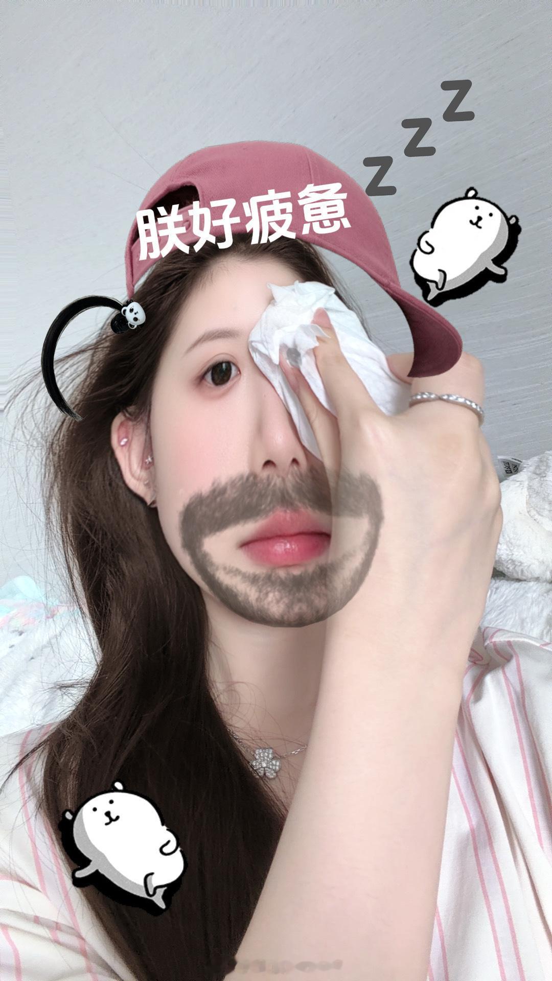 麦粒肿热敷小技巧！保鲜袋里放热水！包一层洗脸巾～ 