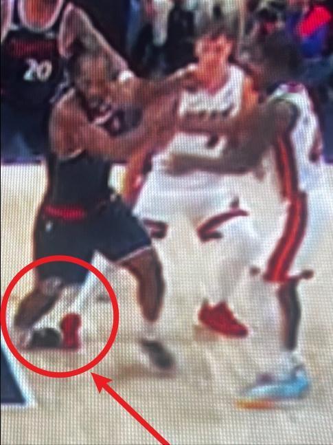 小卡扭伤脚踝瞬间曝光：90度崴脚！

从画面上看，这次崴脚自然十分严重，有可能是