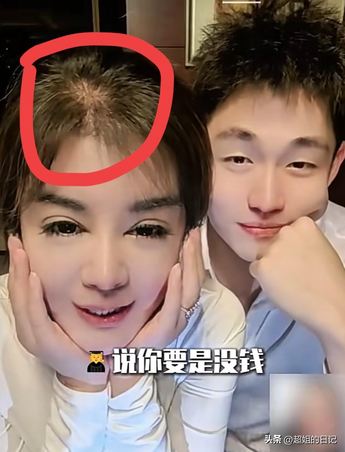 有谁看到过18岁的身体状态会这么少的头发，这就是年纪大了，最简单的一个原因就是，