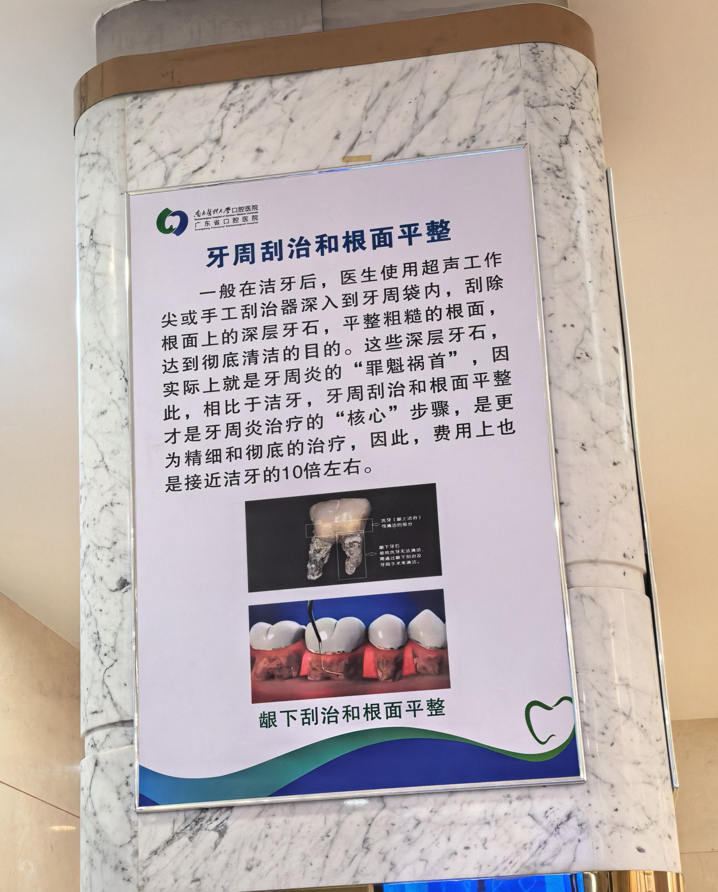 做了半口牙周治疗，结论就是不疼！感觉很舒缓就做完了，我是中度牙周炎了… ​​​