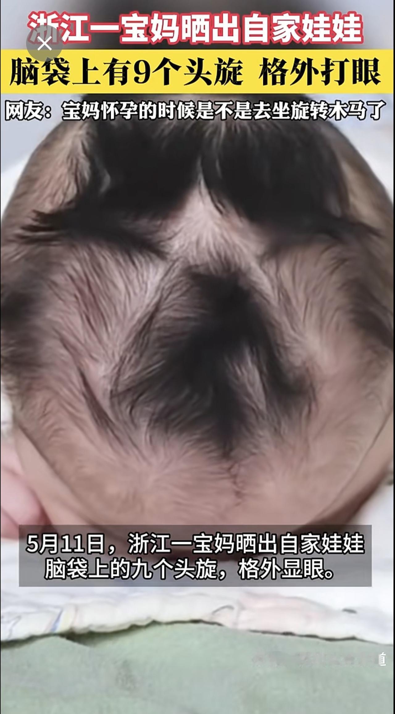 浙江一宝妈晒出自家娃娃脑袋上9个头旋 格外打眼。
