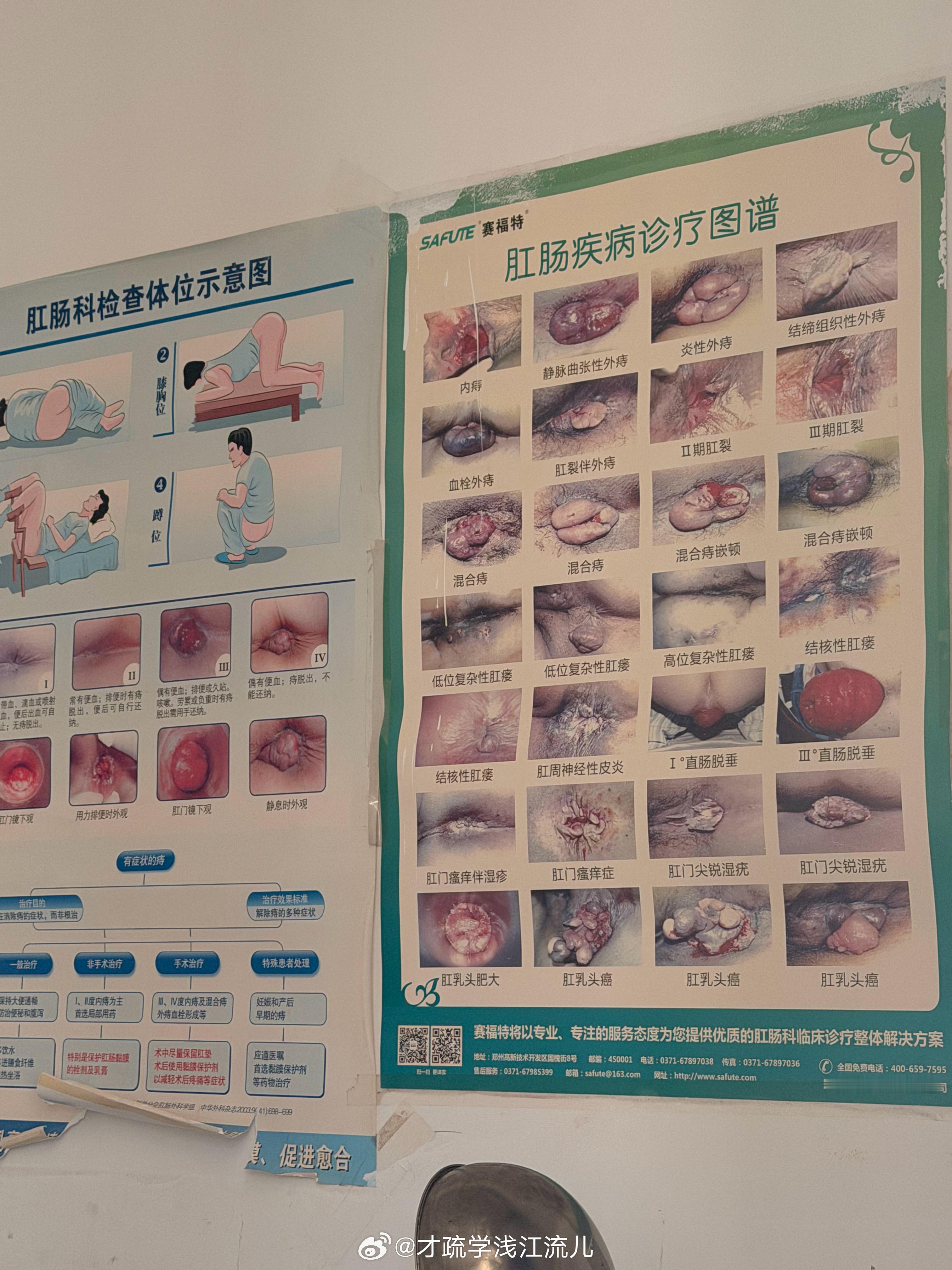 慎点大图，在医院看到的科普图，大家可以对照一下。 ​​​