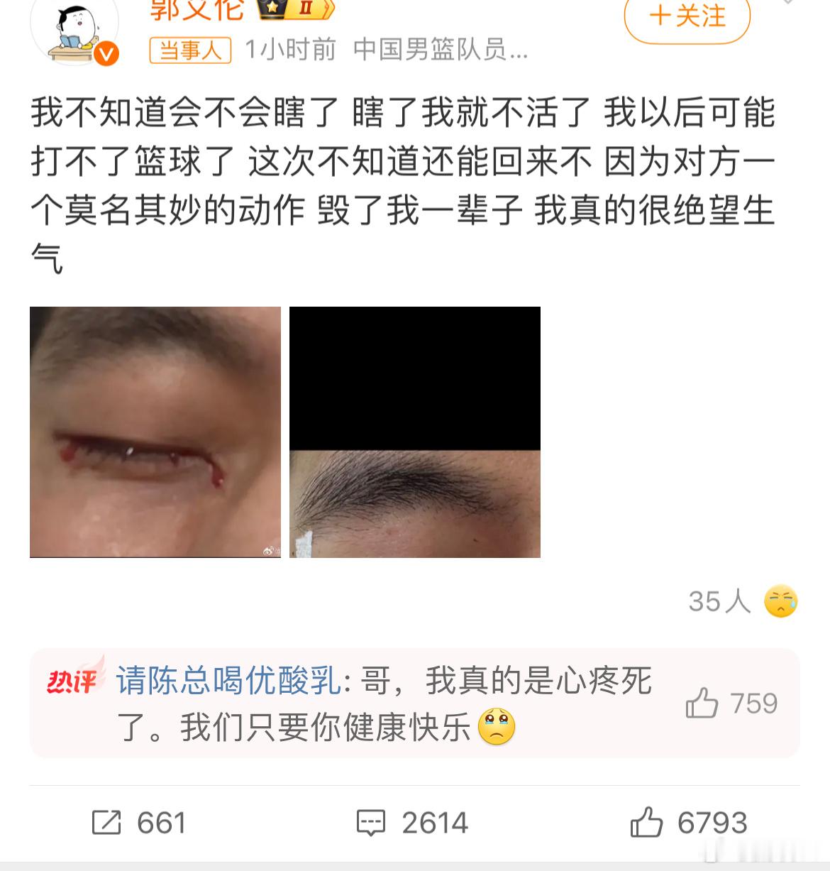 这比追梦格林还猛，郭艾伦训练中受伤 