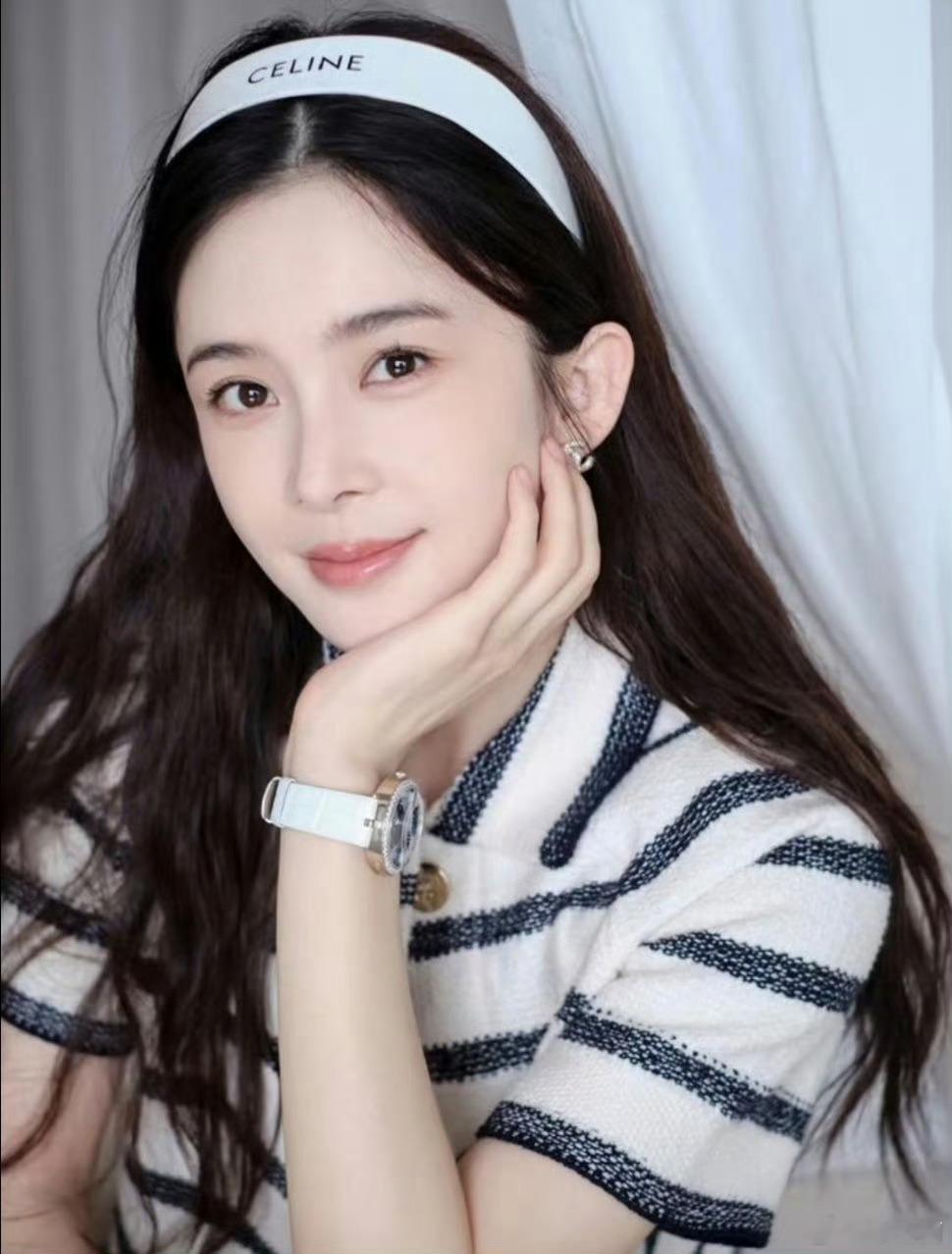 赵樱子又医美了底子好 锦上添花 