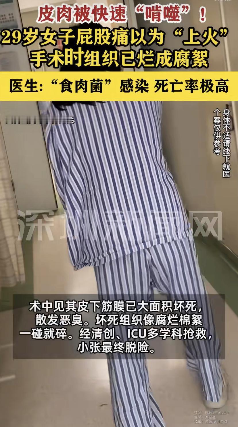 浙江一位29岁姑娘，屁股长了个小包，以为只是上火，随手抹了点药膏。
结果呢?24