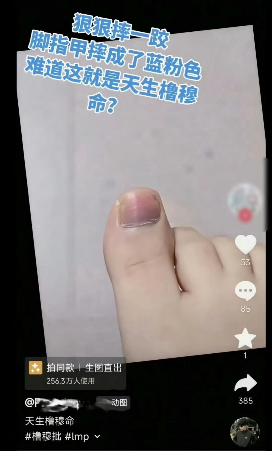 谁绷住了？有人吗