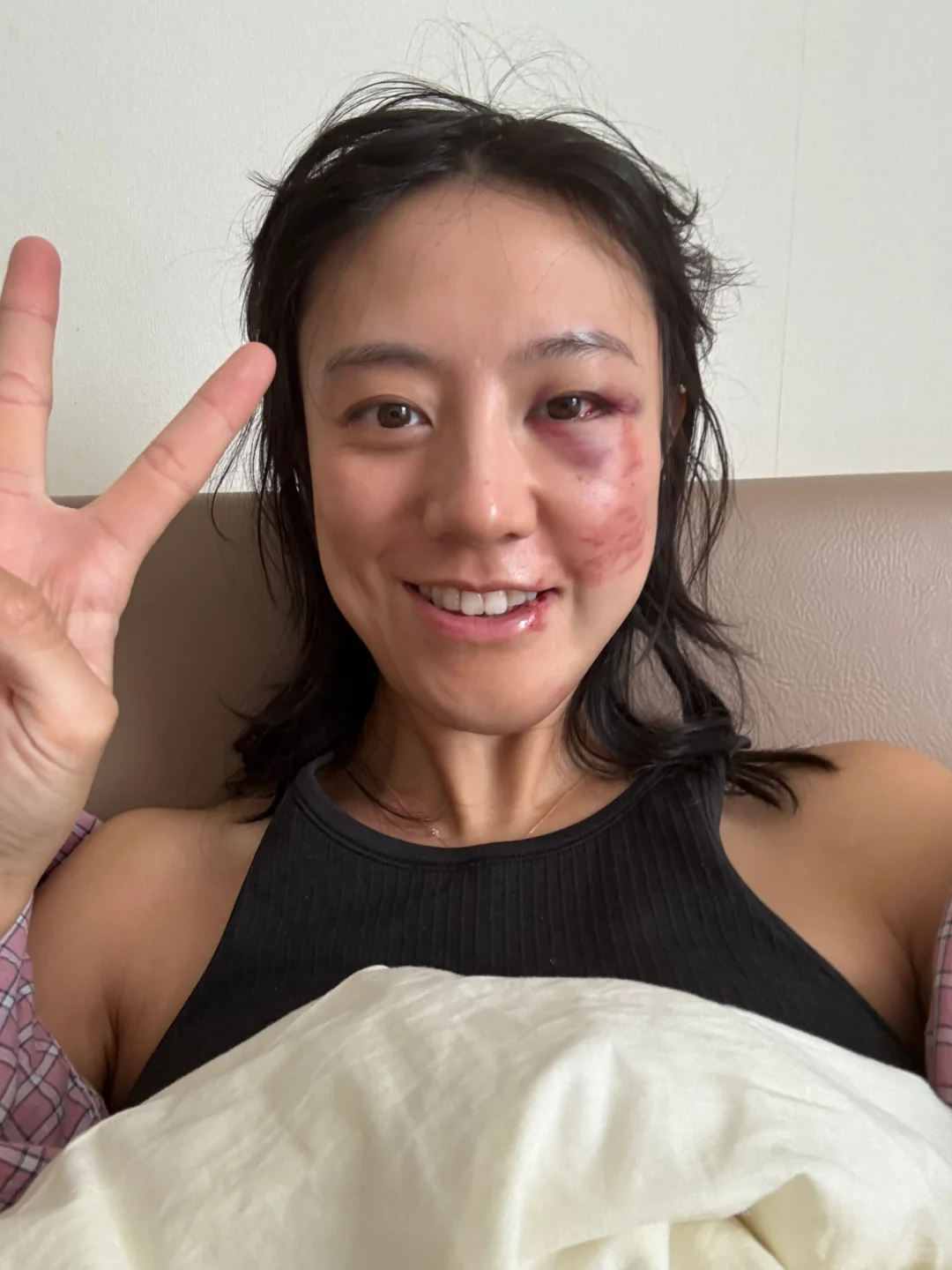 关于我滑雪撞树 变成猪头这件事