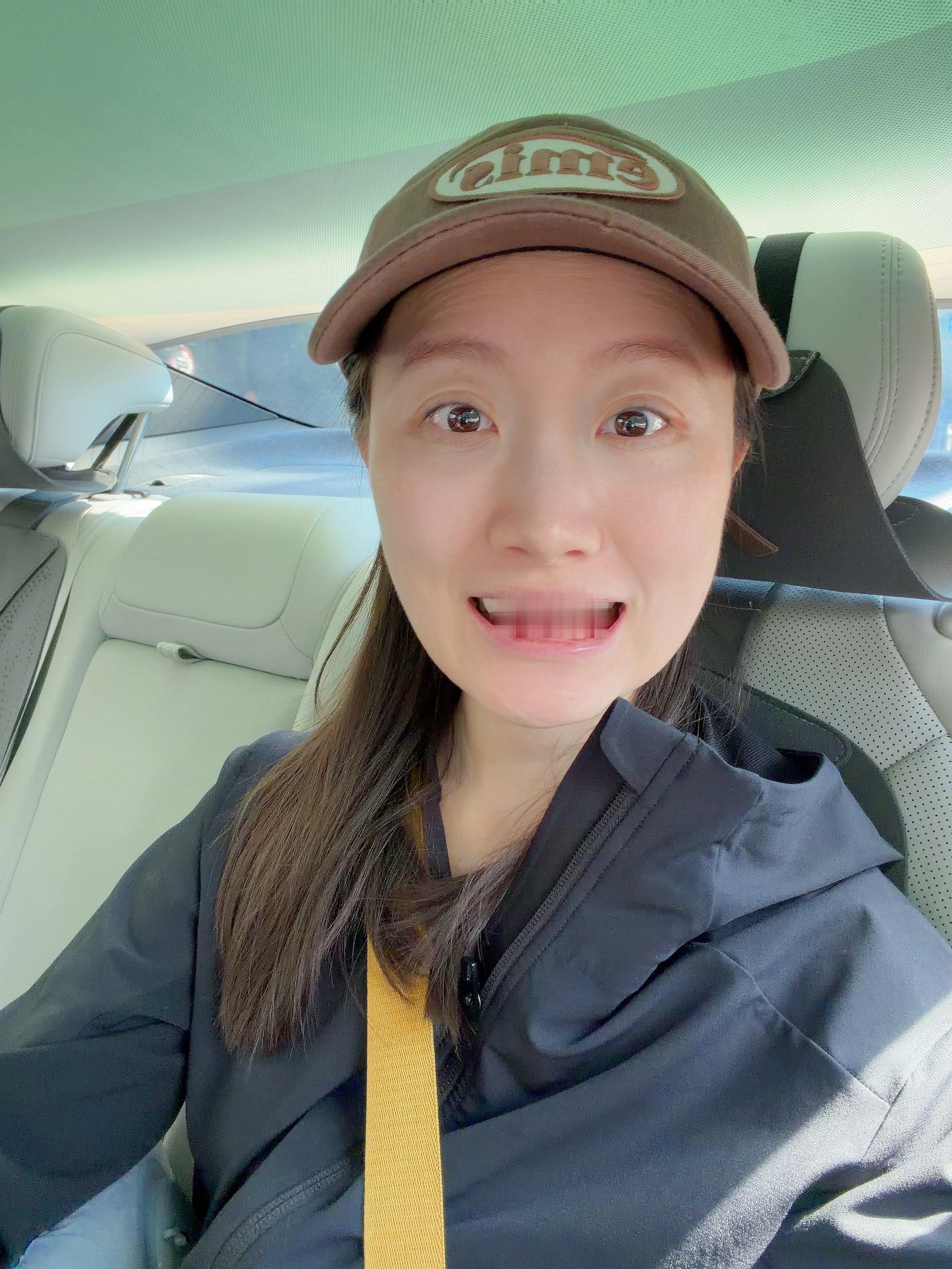 真的补了3颗牙而且还剩几颗下次继续[泪]大家一定要保护好牙齿🦷 ​​​