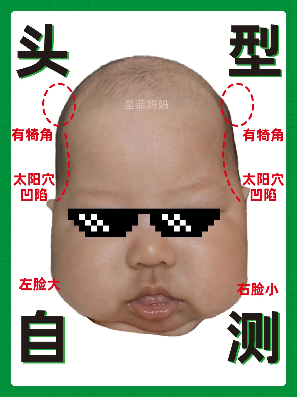 头型自测|不求人帮宝宝睡圆头攻略。