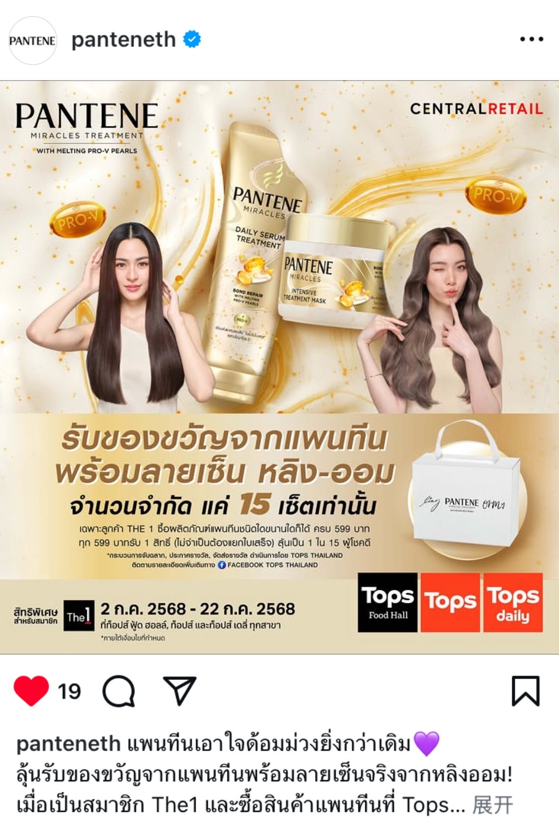 潘婷更新邝邝毛毛相关好般配的两张脸 ​​​