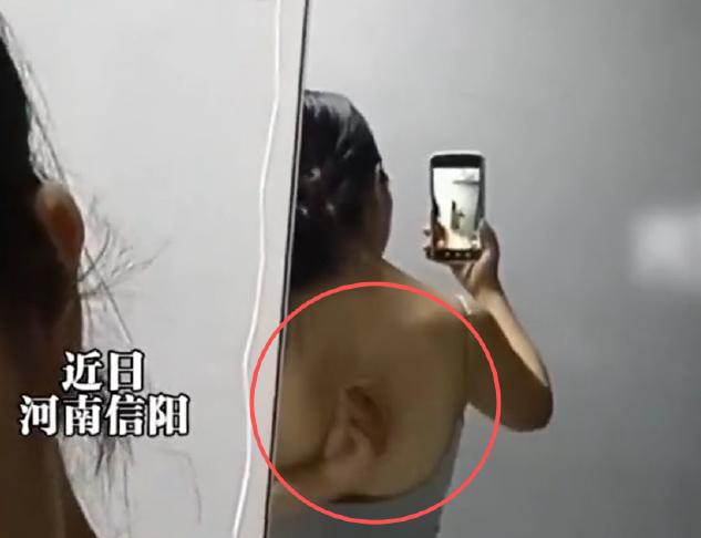 河南信阳，女子洗完澡之后，裸 着上身说表演个节目，她的后背竟然可以吸住磁铁。女子