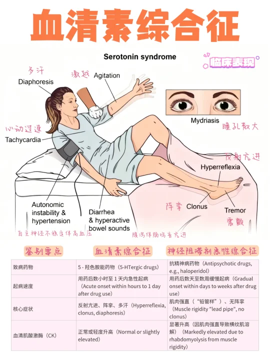 备考RN/血清素综合征！！学！！内容