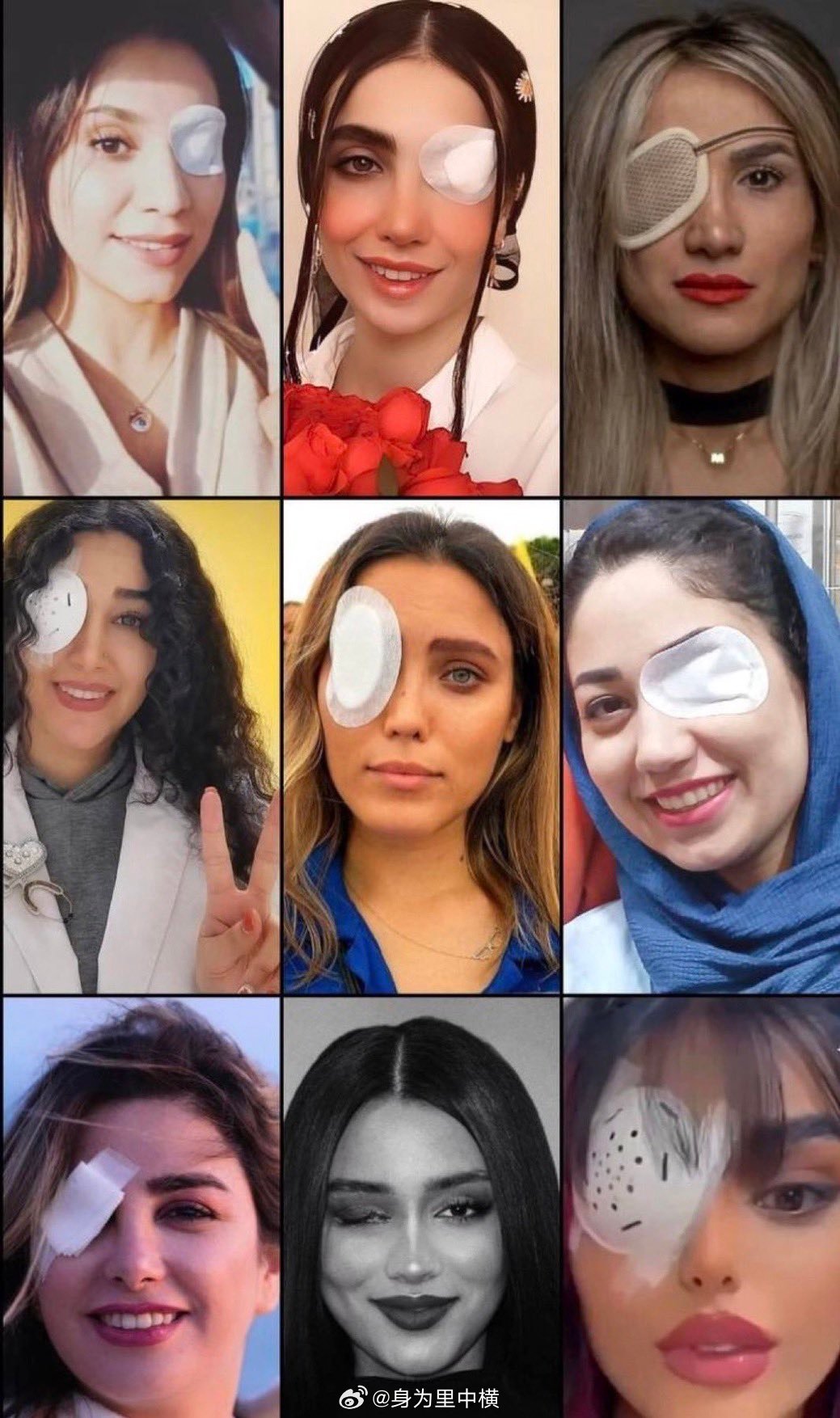 这些伊朗妇女都是过去几年内抗议神权，因争取妇女权利而被打伤的，如今一直眼睛的她们