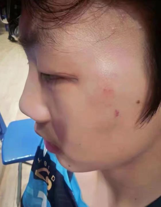 被曹彦灏打的小男孩，下手真的重。

这男孩子和曹彦灏本身是认识的，也一起打球，江
