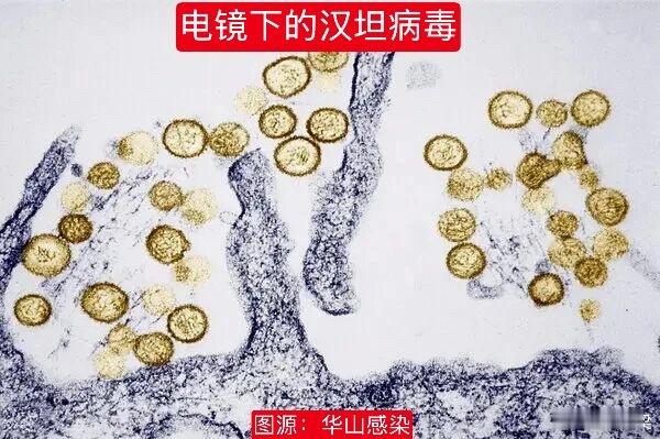 汉坦病毒从发病到死亡仅5天汉坦病毒疫情 可以从四个科学角度安慰大家，不用担心汉坦