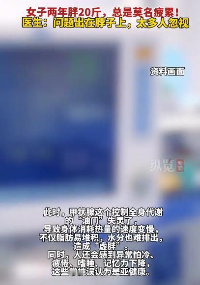 【女子2年胖20斤常感疲累确诊甲减】医生回应女子2年胖20斤确诊甲减 近日，福建