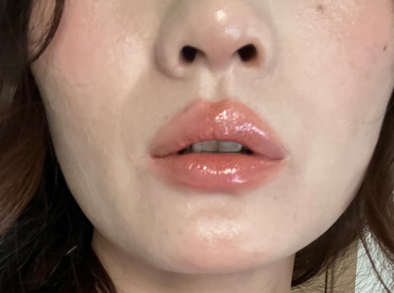 尽管单生的法令纹隐隐约约，但存在，还割破了鼻翼，那就是影响。 