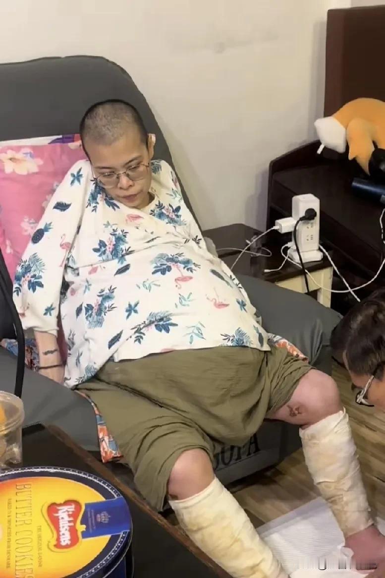 有人认识她吗？网红丁丁老师。

别误会，她不是怀孕了，这么大的肚子是因为她得了卵