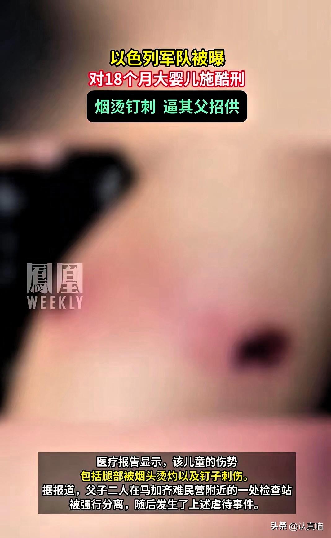 凤凰网披露的这一幕，
看得人浑身发寒，
这早已超出了审讯的底线。
以军士兵不动被