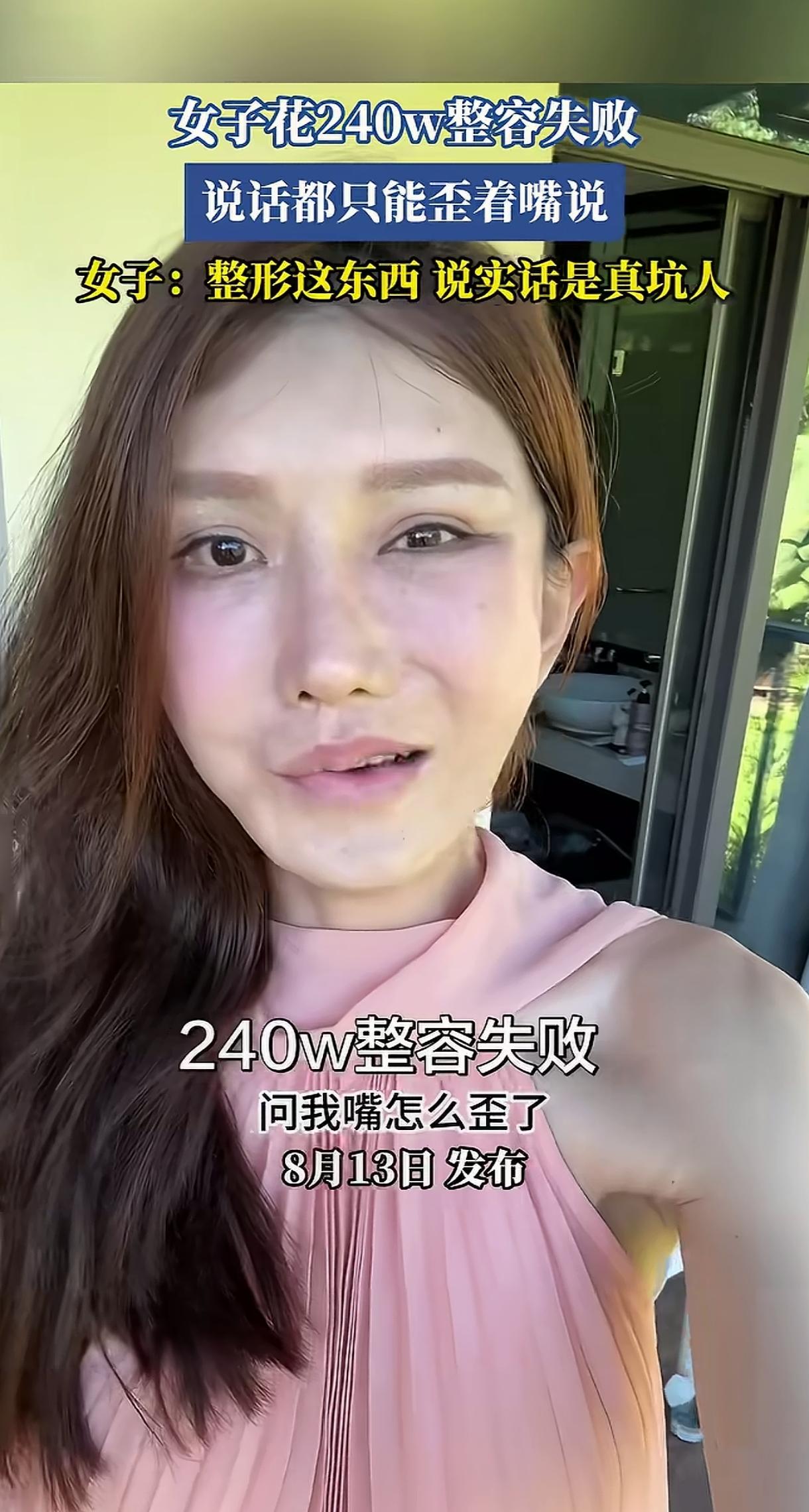 爱美之心，人皆有之。可你花240万去整容，最后却把自己给整残了，是该同情你呢？还