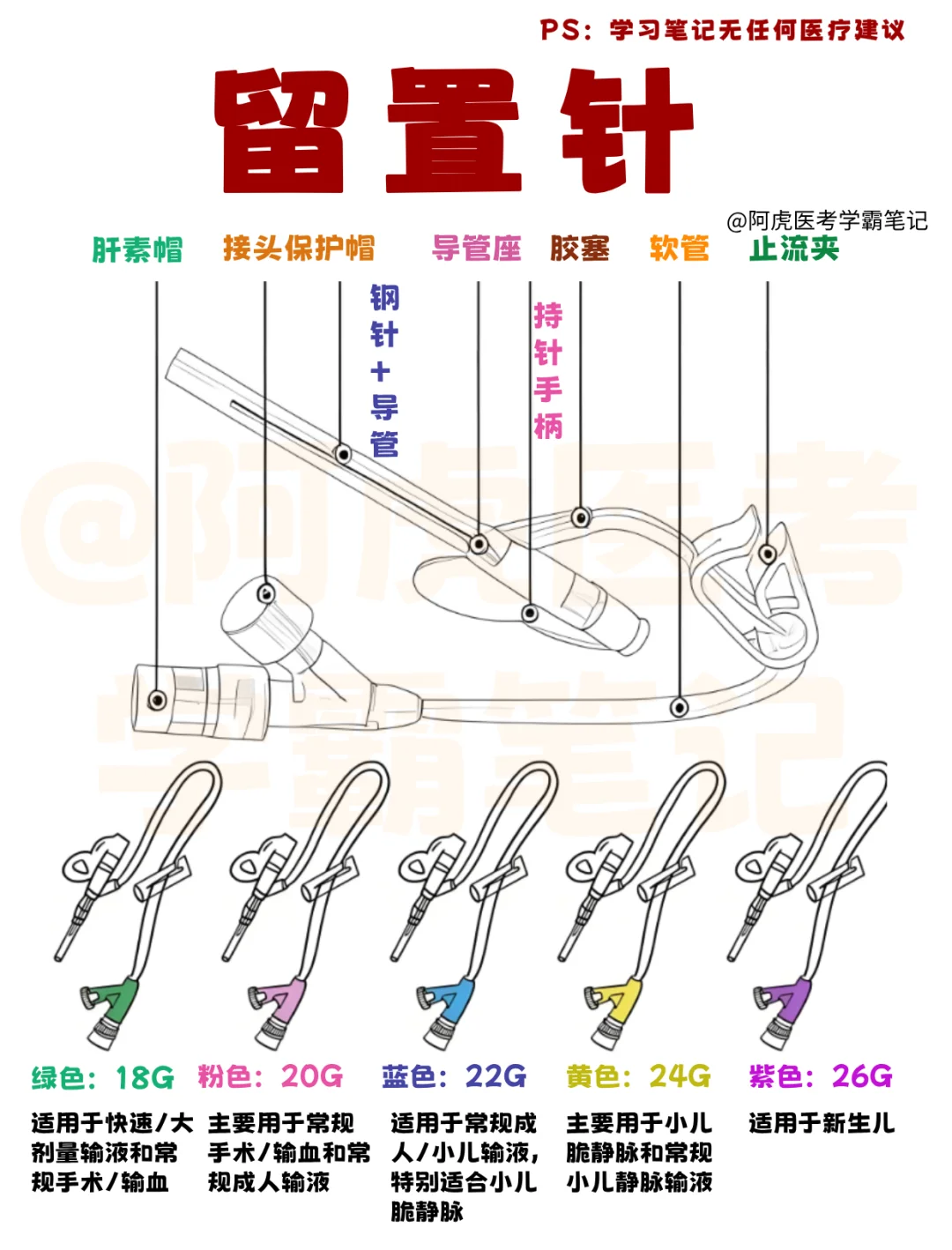 医学生笔记📒：各种颜色的留置针👆