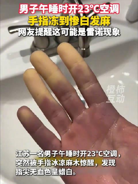 看着就吓人！7月1日报道，江苏一名男子在23度的空调房里睡午觉，竟然被一阵刺骨的