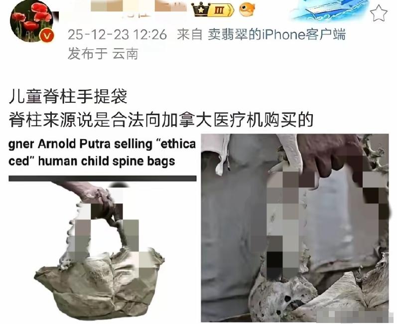 牢A：老美的儿童保护法为什么那么严格呢？因为一副完整的儿童骨架价值8000美刀。