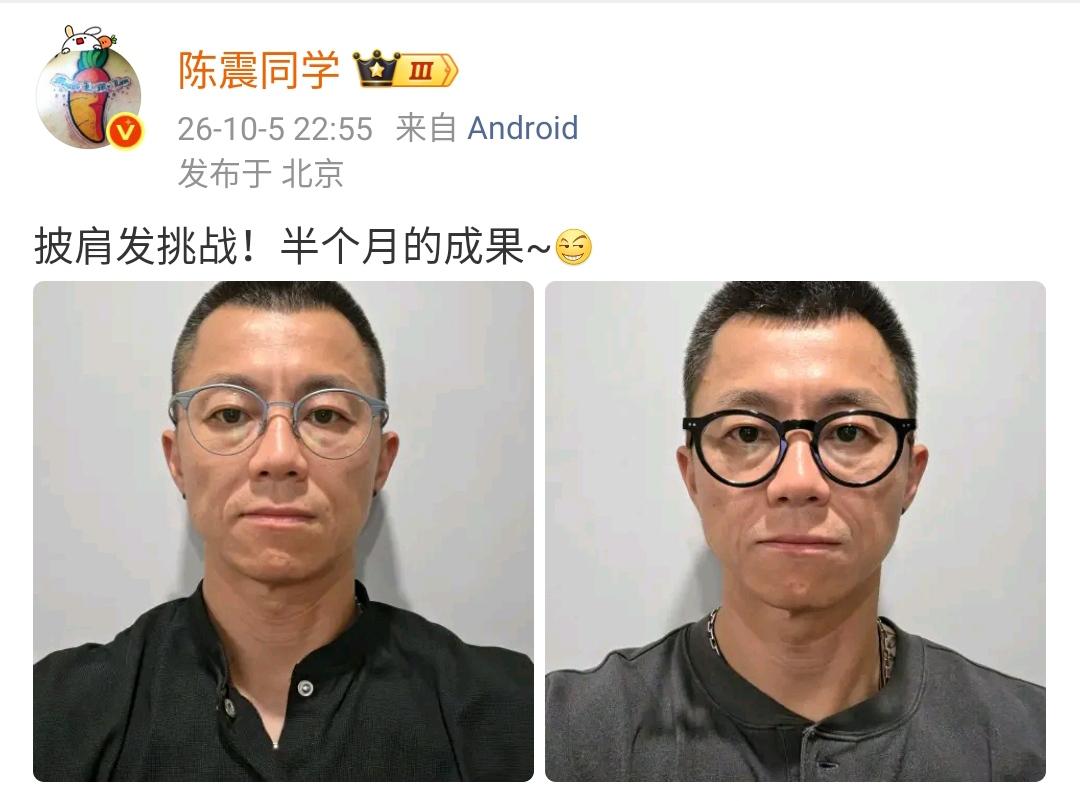 陈震：披肩发挑战！半个月的成果~[奸笑]  ​​​

半个月头发长得不是很长呀，
