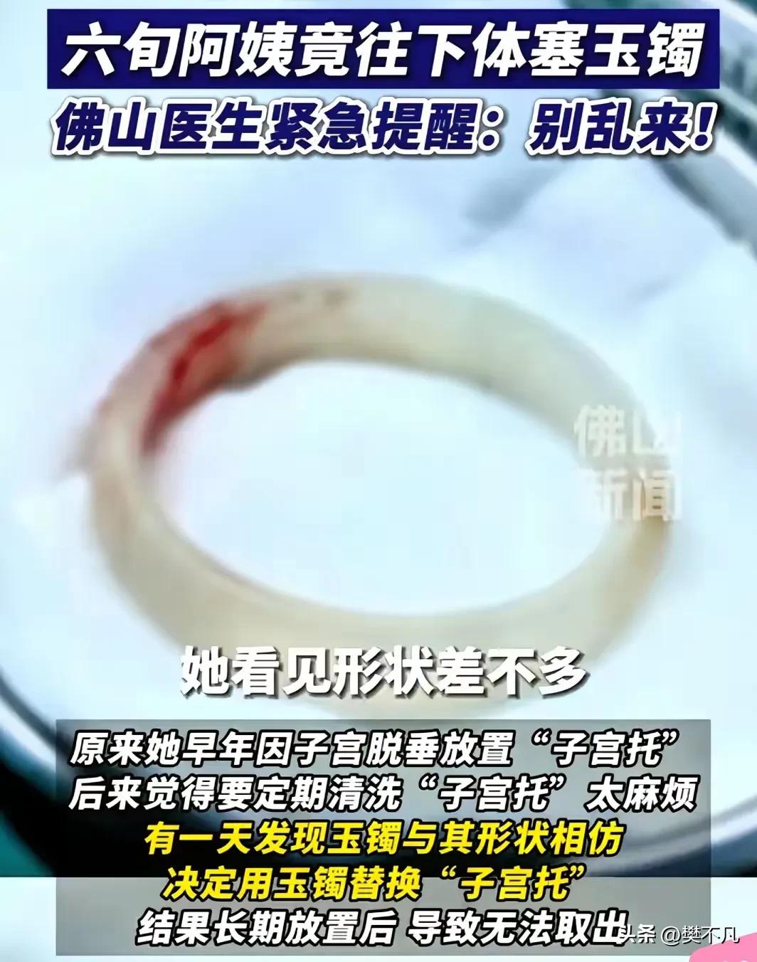 65岁大妈下体疼得受不了，医生一看懵了：里面卡着一只玉镯子！

广东，65岁的王