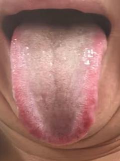 长期耗损引发肝脾不和，反复腹痛反酸泄泻，该如何疏肝健脾调理？







前段