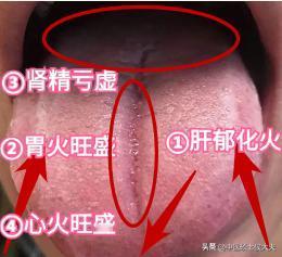 20出头的年纪，50多岁的肾，小伙子太不节制了，手一定要戒掉！

患者主诉：腰膝