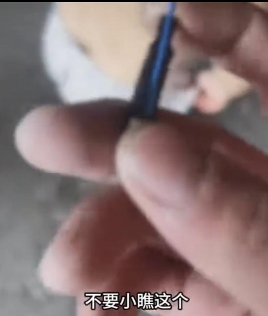 广西一女童洗澡时被哥哥用打火机点火器电击：右肩大面积烧伤，2025年9月15日晚