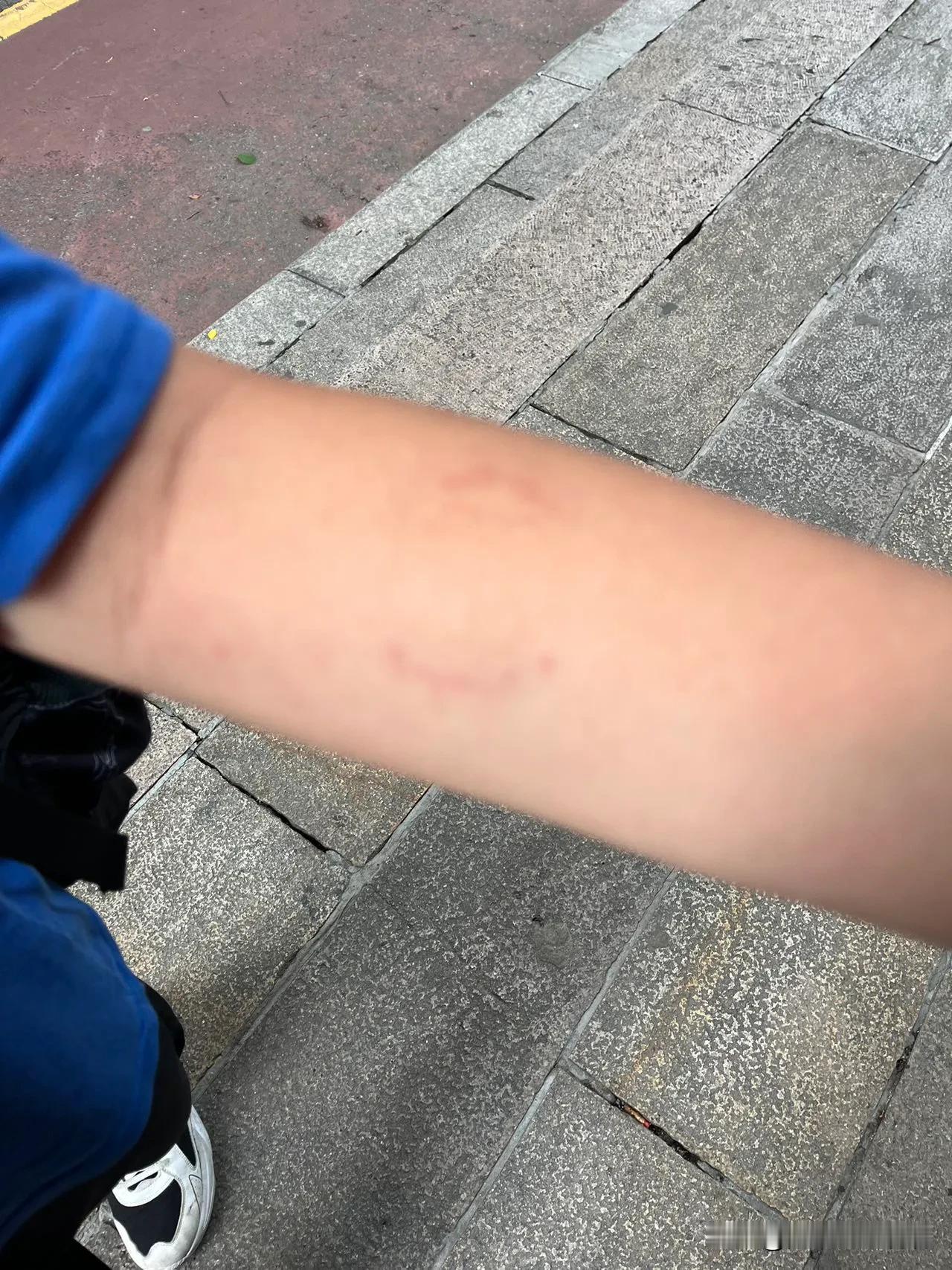 刚老师又打电话给我了。
说要留我家孩子下来做作业，结果孩子一下子就跑了。
因为孩