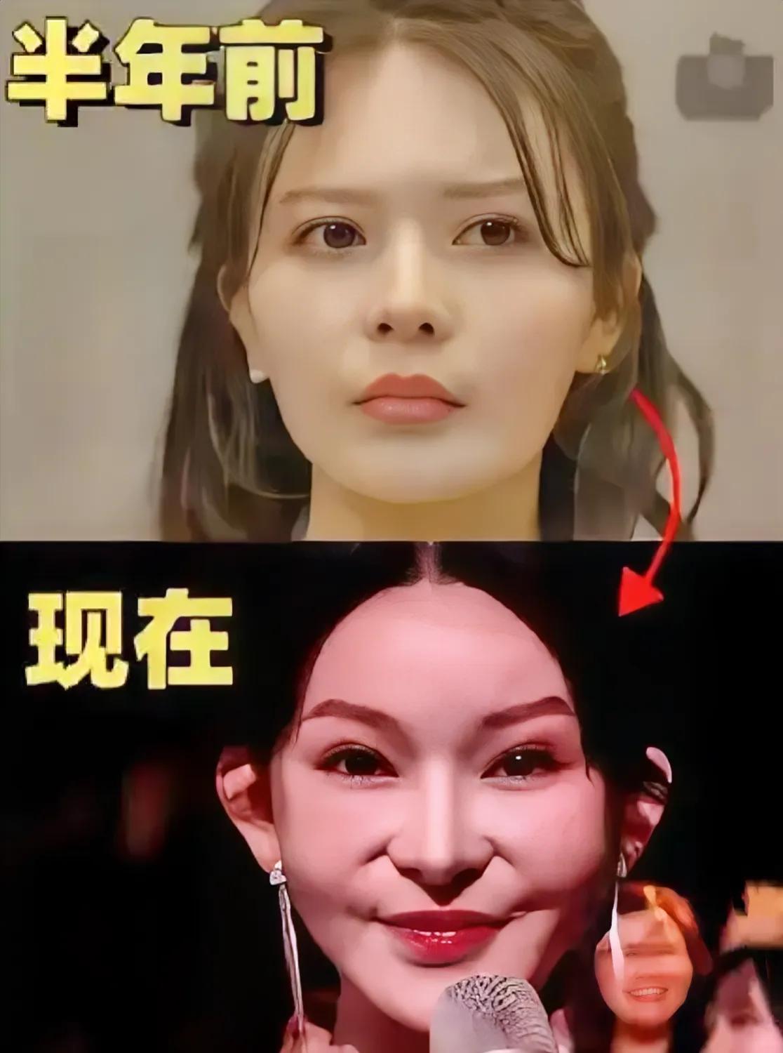 为啥要整，不是每个人都适合整瓜子脸  #整容#
