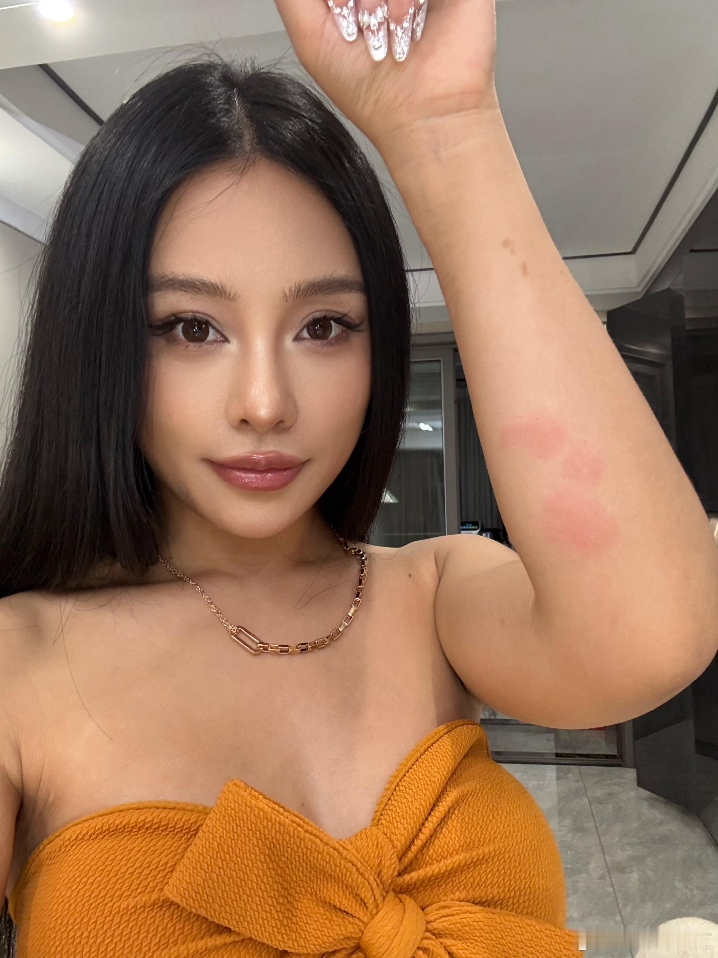 这两天经常莫名其妙的被咬 又痒有刺痛最后还是晚晚提醒我“妈妈应该是蚂蚁咬的吧”因