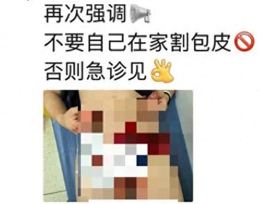 是个狠人啊。上海，一24岁小伙血气方刚，一直因为包皮过长不敢和女友过爱爱的生活，
