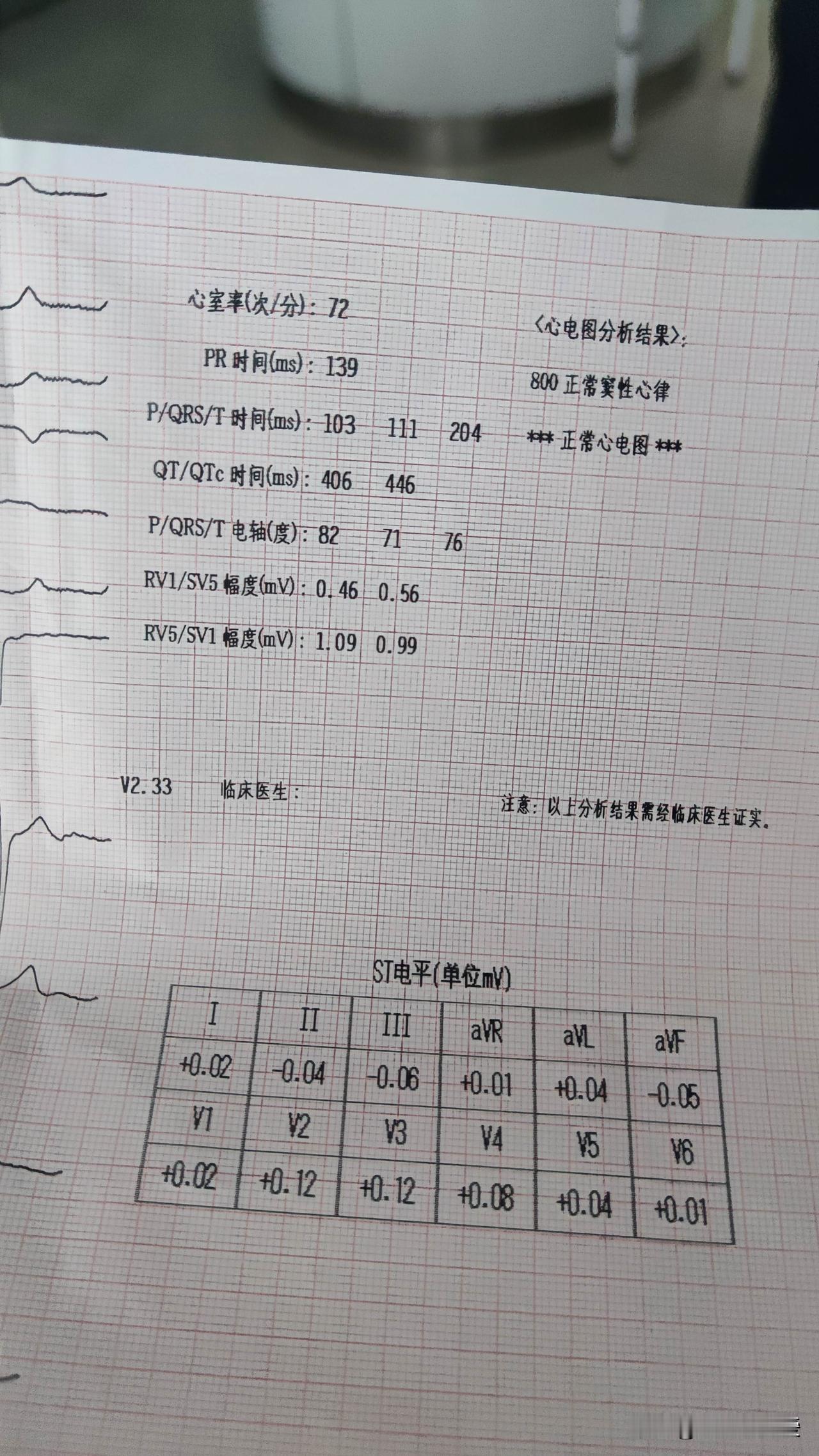 夏日生活里，了解点医学知识也挺有必要，就比如心电图怎样算正常。正常心电图有几个关