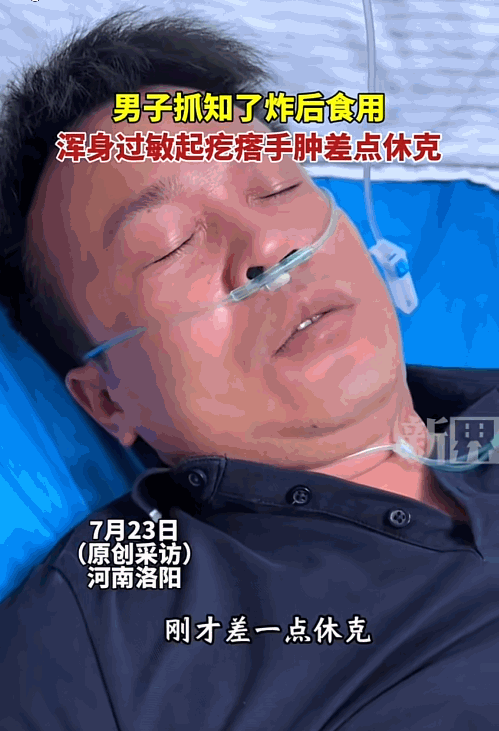 “看你还敢不敢吃！”据媒体2024年7月23日报道，河南洛阳，一男子嘴馋就花10