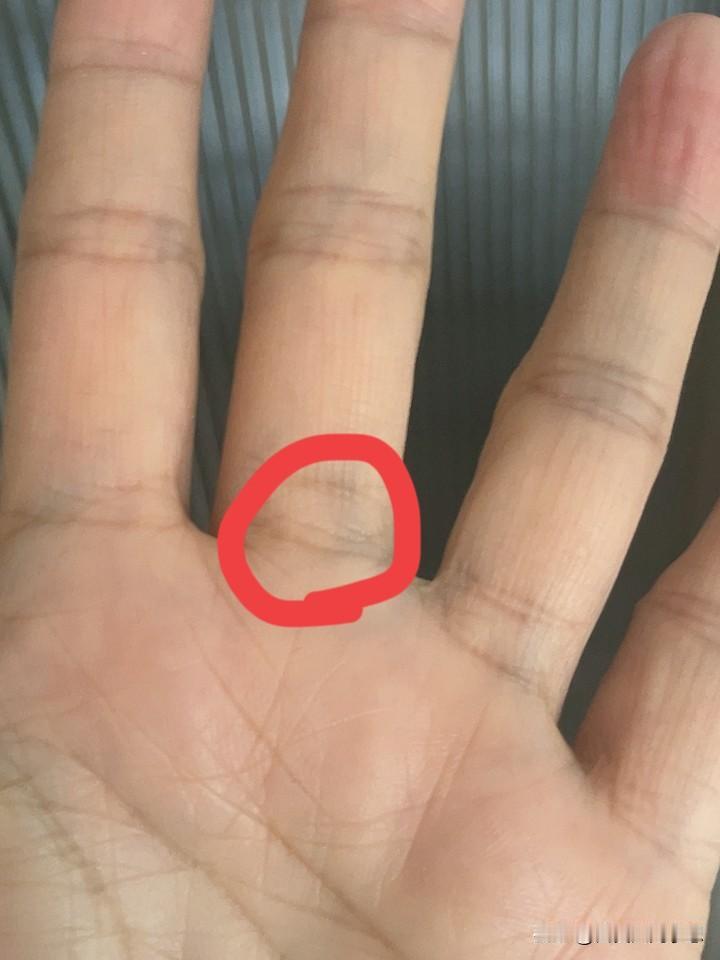 奇怪又惊喜！来的突然去的也突然！

年前的一天和女儿一起去取快递，走到路上感觉左