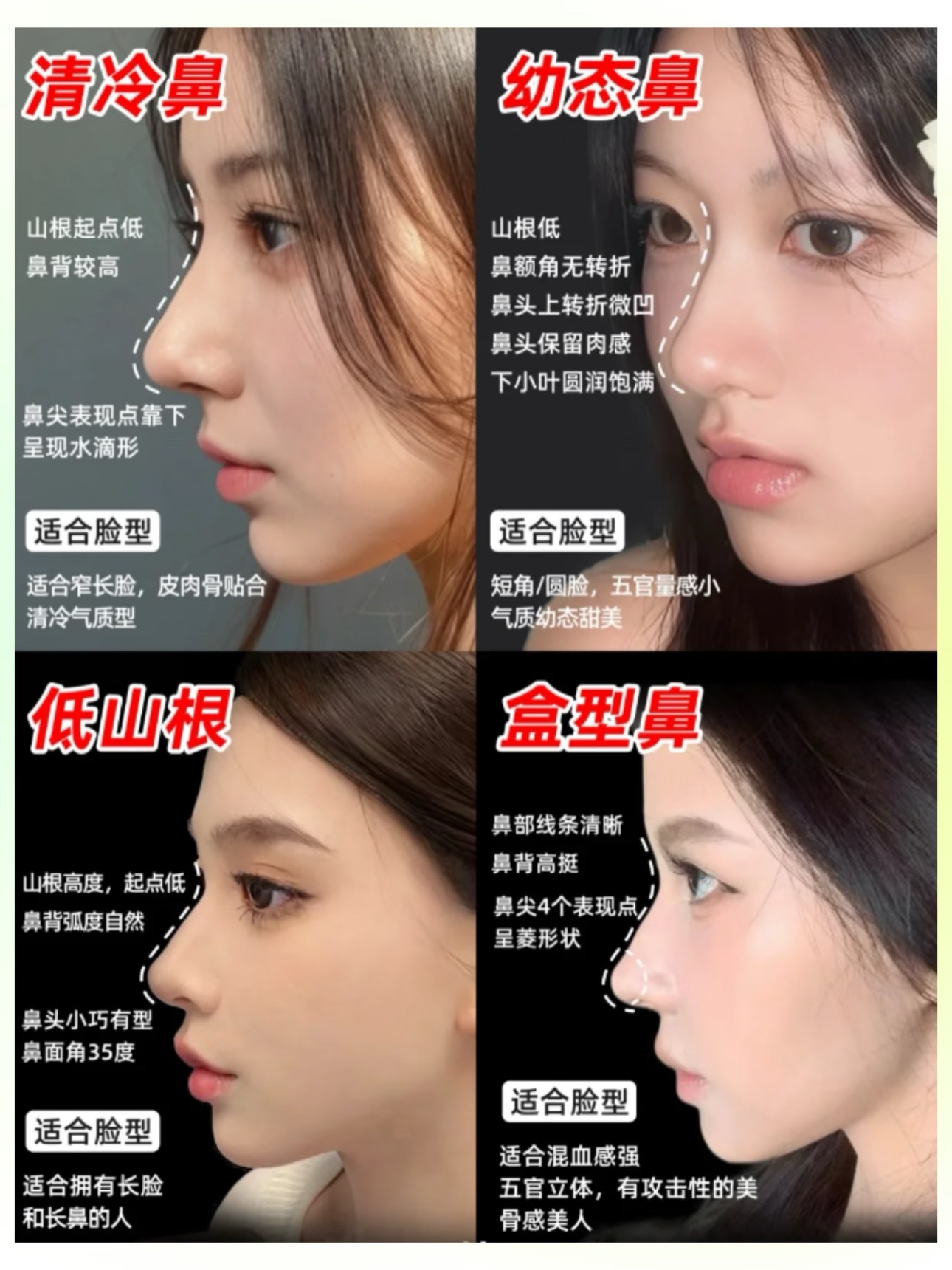 我有一个朋友要去做鼻子我就在那边帮忙参谋说实话做鼻子最好就是肋骨➕膨体现在又出了