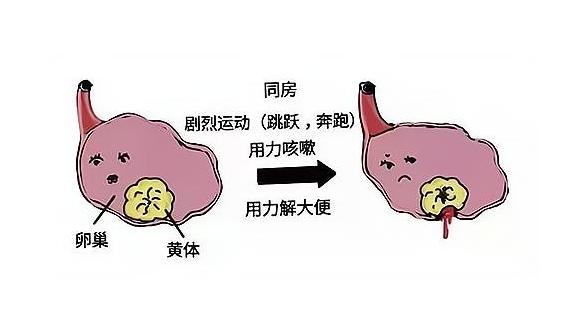 【患者提问】我和我爱人刚结婚不久，他是跑大车的，一出车最少就是半个月， 有时候一