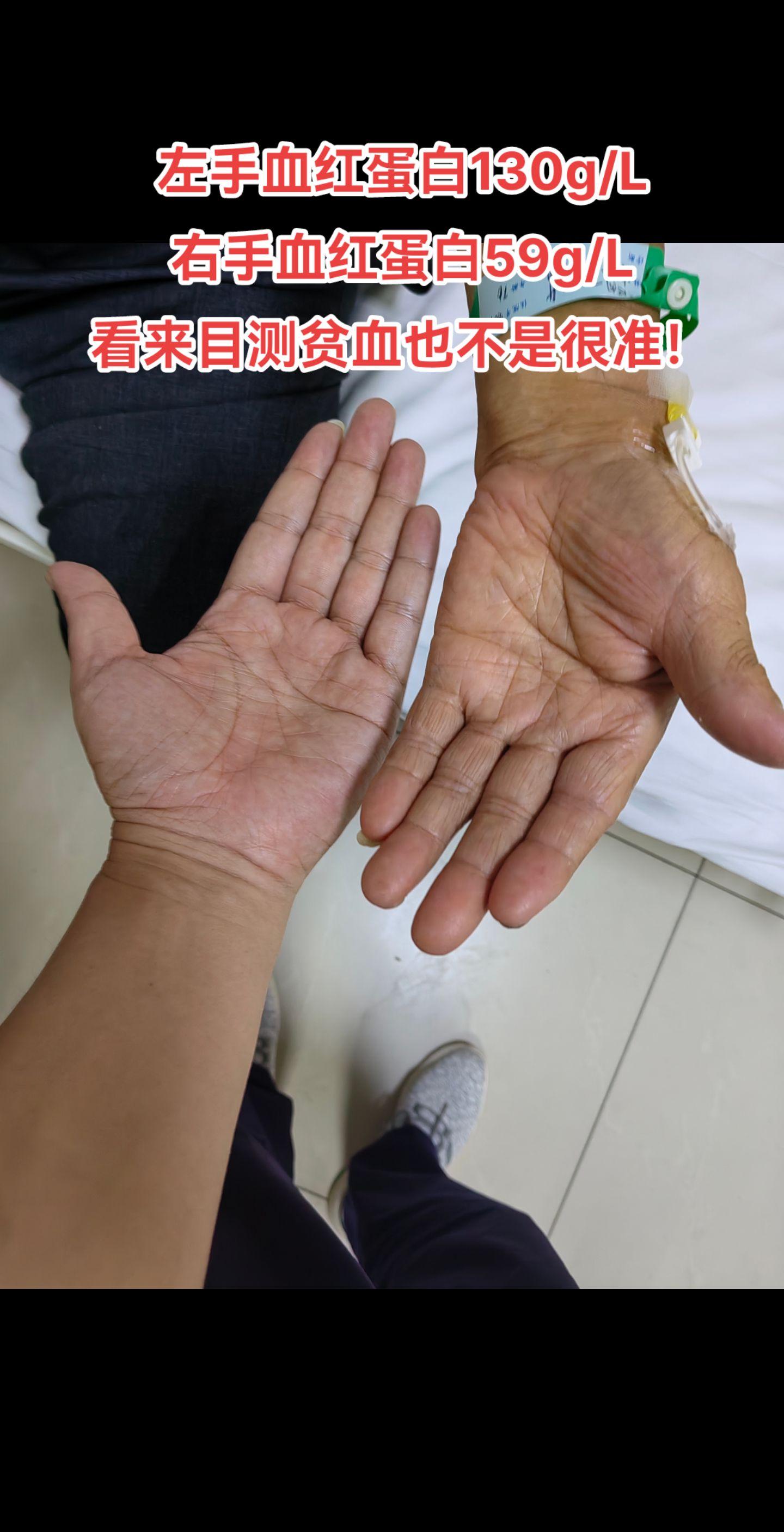 医生日常 医学科普 我的手心有惊喜 医路前行 干活的手