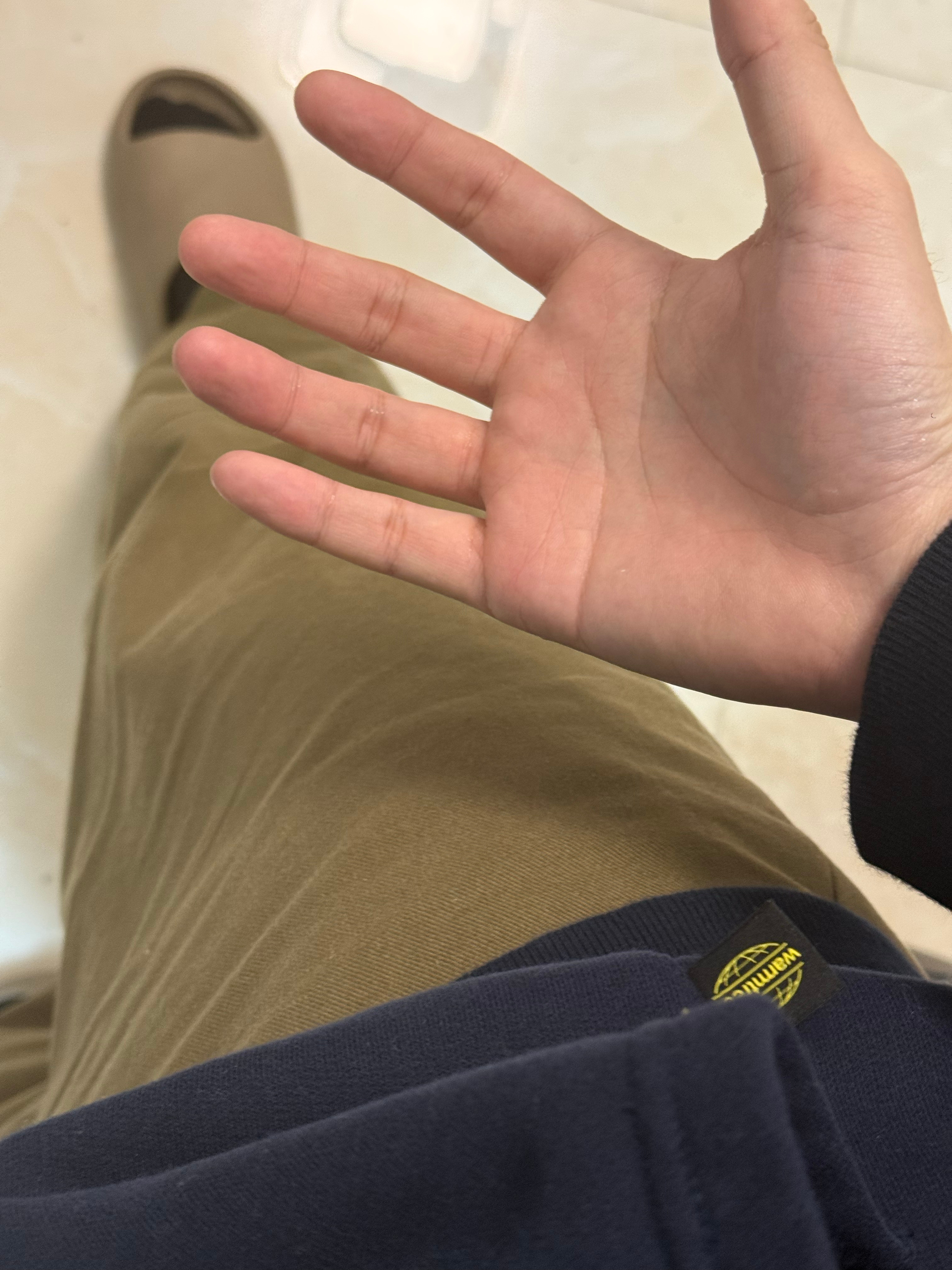 啊啊啊啊啊[苦涩][苦涩][苦涩]我这次真的脏了在沙发躺着，结果有只蟑螂🪳爬到