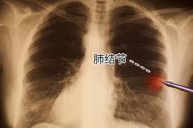 看到免开刀治疗肺结节的研究，是针刺穿孔精确切除的微创手术。怎么评价这个手术？扯淡
