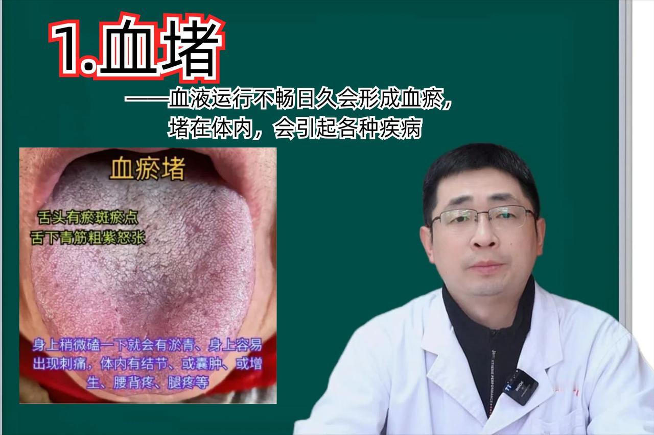 身体堵不堵，看舌就知道，有这三种堵要注意！