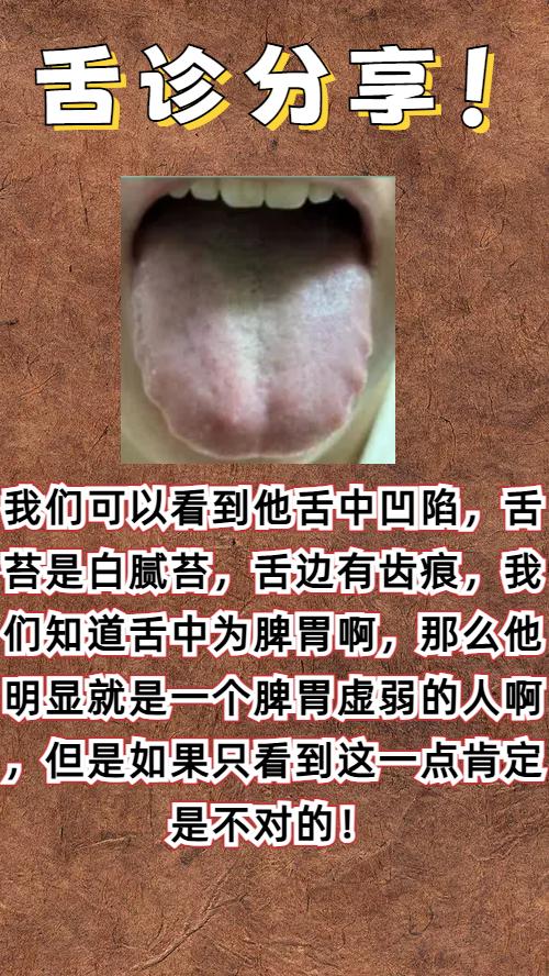 看见齿痕就健脾，其他的问题是一点也不管，你能好就怪了！

我们来看这位朋友的舌象