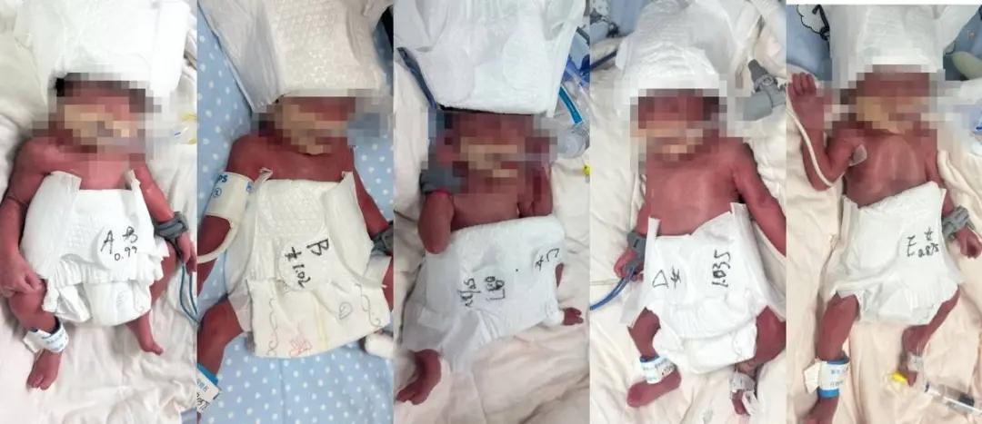 24岁的新疆妈妈迪丽，在武汉迎来了五胞胎的降生，这简直是千万分之一的生命奇迹啊！