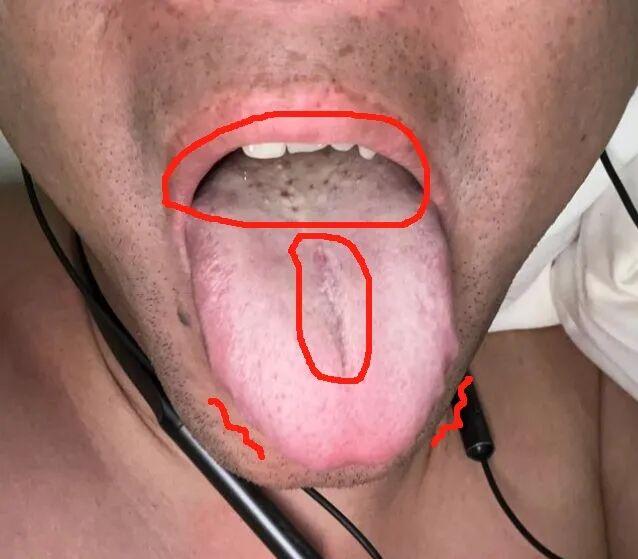 肾阳虚调理攻略：温补肾阳，改善脾胃功能是关键
肾阳虚症状在您身上表现得较为明显，